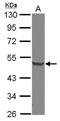 Decapping MRNA 2 antibody, NBP2-16109, Novus Biologicals, Western Blot image 