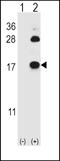 Fatty Acid Binding Protein 4 antibody, LS-B4227, Lifespan Biosciences, Western Blot image 