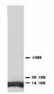 ATP Synthase Peripheral Stalk Subunit F6 antibody, LS-C171666, Lifespan Biosciences, Western Blot image 