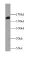 Rho Associated Coiled-Coil Containing Protein Kinase 1 antibody, FNab07377, FineTest, Western Blot image 