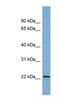 BTG Anti-Proliferation Factor 4 antibody, NBP1-58173, Novus Biologicals, Western Blot image 