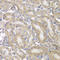 Keratin 17 antibody, LS-C331957, Lifespan Biosciences, Immunohistochemistry frozen image 