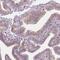 Dynein Regulatory Complex Subunit 3 antibody, NBP1-84128, Novus Biologicals, Immunohistochemistry frozen image 