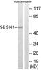 Sestrin 1 antibody, LS-C120385, Lifespan Biosciences, Western Blot image 