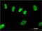 Zinc Finger Protein 101 antibody, H00094039-M01, Novus Biologicals, Immunofluorescence image 