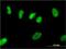 Zinc Finger Protein 101 antibody, H00094039-M01, Novus Biologicals, Immunofluorescence image 