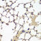 Estrogen Receptor 2 antibody, LS-C332153, Lifespan Biosciences, Immunohistochemistry paraffin image 