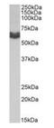 Anti-Mullerian Hormone Receptor Type 2 antibody, orb233603, Biorbyt, Western Blot image 