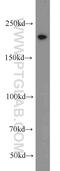 Treacle Ribosome Biogenesis Factor 1 antibody, 11003-1-AP, Proteintech Group, Western Blot image 