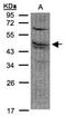 Farnesyl-Diphosphate Farnesyltransferase 1 antibody, NBP1-32147, Novus Biologicals, Western Blot image 