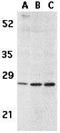 TNF Receptor Superfamily Member 17 antibody, GTX31660, GeneTex, Western Blot image 