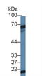 Dyskerin Pseudouridine Synthase 1 antibody, LS-C725553, Lifespan Biosciences, Western Blot image 