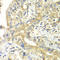Translocase Of Inner Mitochondrial Membrane 17A antibody, LS-C334728, Lifespan Biosciences, Immunohistochemistry paraffin image 