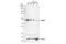 Preferentially Expressed Antigen In Melanoma antibody, 56426S, Cell Signaling Technology, Western Blot image 
