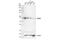 Melanoma antigen preferentially expressed in tumors antibody, 56426S, Cell Signaling Technology, Western Blot image 