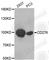 CD276 Molecule antibody, A5002, ABclonal Technology, Western Blot image 