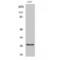 Matrix Metallopeptidase 7 antibody, LS-C384459, Lifespan Biosciences, Western Blot image 