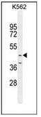 Otoconin 90 antibody, AP52986PU-N, Origene, Western Blot image 