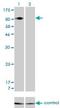 Integrin Subunit Beta 5 antibody, H00003693-M01, Novus Biologicals, Western Blot image 