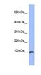 Acyl-CoA Binding Domain Containing 7 antibody, NBP1-56527, Novus Biologicals, Western Blot image 