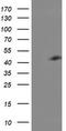 Centromere protein H antibody, CF503874, Origene, Western Blot image 