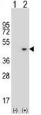 Alpha-2-Glycoprotein 1, Zinc-Binding antibody, GTX81802, GeneTex, Western Blot image 