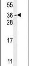 Myc target protein 1 antibody, PA5-24018, Invitrogen Antibodies, Western Blot image 