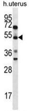 Actin Binding Rho Activating Protein antibody, AP50033PU-N, Origene, Western Blot image 
