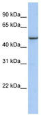 Transmembrane Protein 184A antibody, TA334991, Origene, Western Blot image 