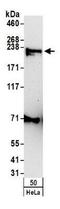 Claspin antibody, GTX23720, GeneTex, Western Blot image 