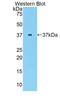 Parathyroid Hormone antibody, LS-C297450, Lifespan Biosciences, Western Blot image 