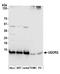 Ubiquinol-Cytochrome C Reductase Complex III Subunit VII antibody, A305-747A-M, Bethyl Labs, Western Blot image 