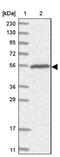 Tripartite Motif Containing 38 antibody, NBP1-87126, Novus Biologicals, Western Blot image 