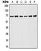 A-Raf Proto-Oncogene, Serine/Threonine Kinase antibody, MBS820719, MyBioSource, Western Blot image 