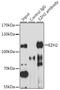 Enhancer Of Zeste 2 Polycomb Repressive Complex 2 Subunit antibody, 15-240, ProSci, Immunoprecipitation image 