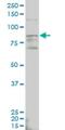 Aldehyde Dehydrogenase 18 Family Member A1 antibody, H00005832-M01, Novus Biologicals, Western Blot image 