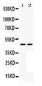 Mitogen-Activated Protein Kinase Kinase 7 antibody, PA5-79628, Invitrogen Antibodies, Western Blot image 