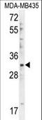DTW Domain Containing 1 antibody, LS-C167553, Lifespan Biosciences, Western Blot image 