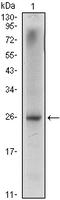 NK3 Homeobox 1 antibody, A02709, Boster Biological Technology, Western Blot image 