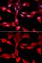 Glutamate-Cysteine Ligase Modifier Subunit antibody, GTX32622, GeneTex, Immunocytochemistry image 