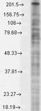 Sodium Voltage-Gated Channel Alpha Subunit 10 antibody, LS-C230959, Lifespan Biosciences, Western Blot image 