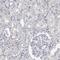 Tenascin R antibody, NBP1-86398, Novus Biologicals, Immunohistochemistry paraffin image 