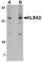 Killer cell lectin-like receptor 2 antibody, A33282, Boster Biological Technology, Western Blot image 