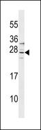 Signal Regulatory Protein Delta antibody, LS-C158973, Lifespan Biosciences, Western Blot image 