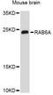 Ras-related protein Rab-6A antibody, abx126451, Abbexa, Western Blot image 