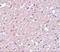 Transmembrane Protein 184A antibody, A14566, Boster Biological Technology, Immunohistochemistry paraffin image 