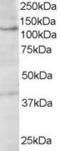 HPS3 Biogenesis Of Lysosomal Organelles Complex 2 Subunit 1 antibody, 45-744, ProSci, Western Blot image 