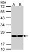 Glutathione Peroxidase 1 antibody, LS-B4802, Lifespan Biosciences, Western Blot image 