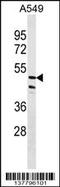 Zinc Finger Protein 708 antibody, 59-629, ProSci, Western Blot image 