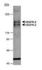 Fms Related Tyrosine Kinase 1 antibody, PA1-16612, Invitrogen Antibodies, Western Blot image 